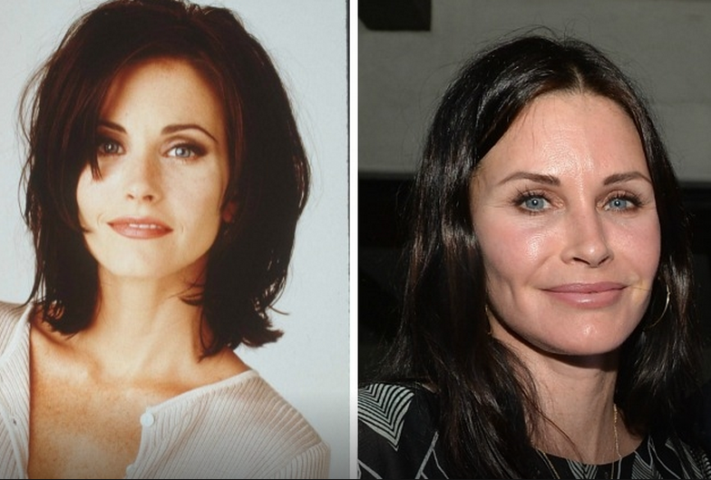 Courtney Cox botulino