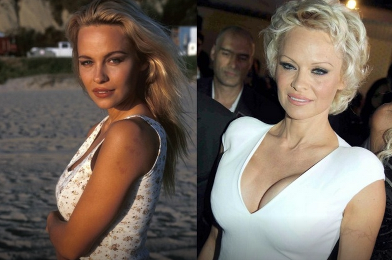 Pamela Anderson rifatta