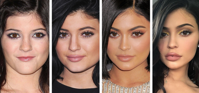 Labbra come quella di Kylie Jenner