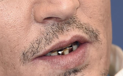 denti depp