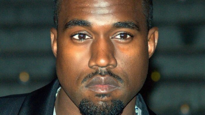 Kanye West e la sua dentatura da squalo