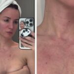 ''Mi sono dimenticata totalmente di collo e petto'': Andrea Delogu mostra i segni del tempo sulla pelle per non aver messo la crema solare