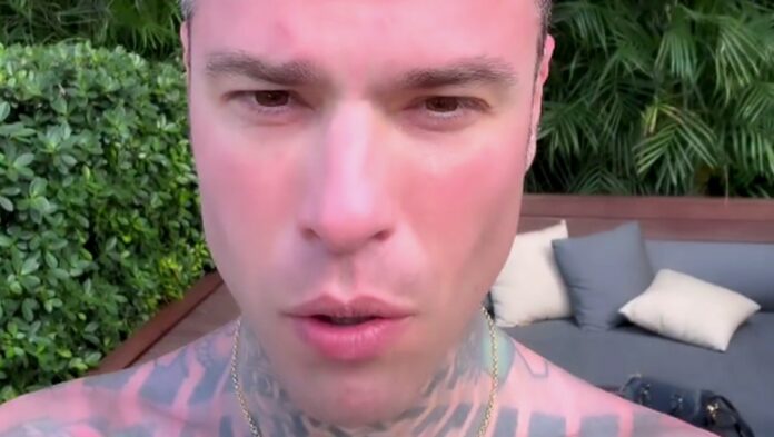 Fedez in vacanza a Miami si brucia la pelle dimenticando di mettere la protezione solare