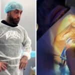 Francesco Chiofalo mostra le immagini impressionanti dell'operazione per cambiare colore degli occhi
