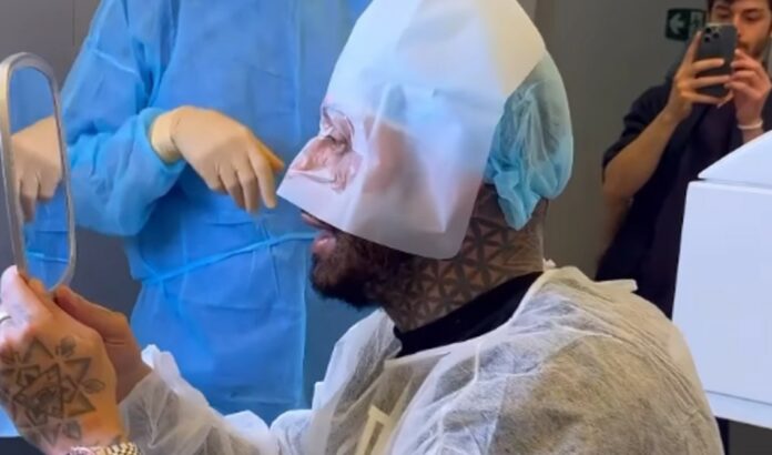 Francesco Chiofalo al controllo dopo l'intervento di cambio colore degli occhi