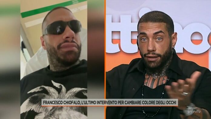 Francesco Chiofalo per la prima volta in tv dopo aver cambiato il colore degli occhi: a Mattino 4 ammette di non sapere cosa potrà succedere