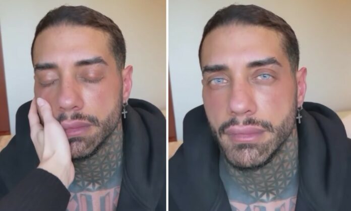 ''Mi ha scossa e disorientata'': Drusilla Gucci spiega cosa pensa del cambio colore occhi del fidanzato Francesco Chiofalo