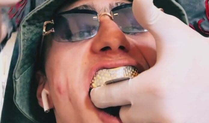 Achille Costacurta si fa fare il grillz