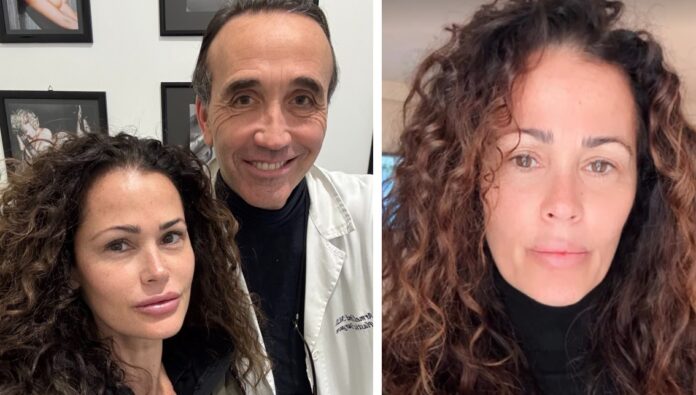 ''Fate pace col cervello'': Samantha De Grenet si altera per le critiche ricevute dopo la visita dal chirurgo plastico e le punturine