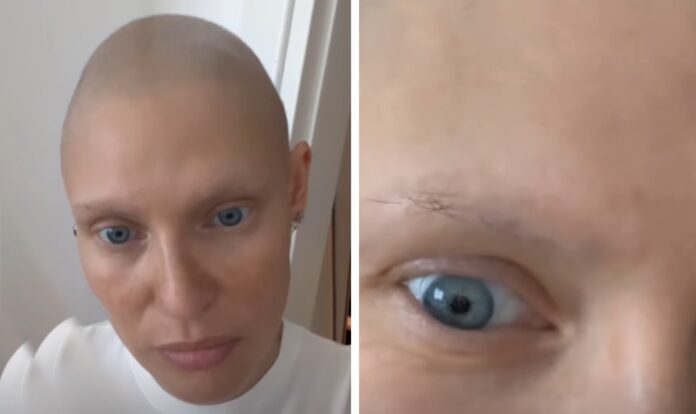Bianca Balti felicissima: le stanno ricrescendo i capelli dopo la chemio e lo mostra orgogliosa ai follower, guarda